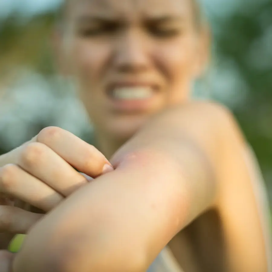 Mujer picadura mosquitos